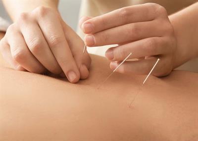<h1>Intorducing Acupuncture To DermaNu Clinic</h1>